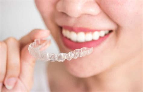 maple grove dentistry|Straighten Your Teeth with Invisalign